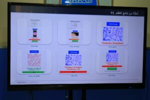 AI-based system for early malaria detection